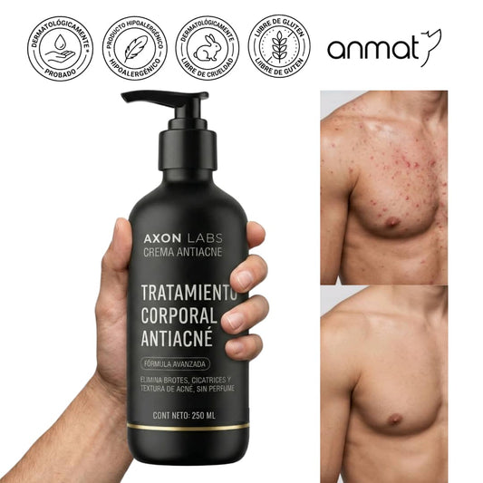 AXON – Tratamiento Corporal Antiacné